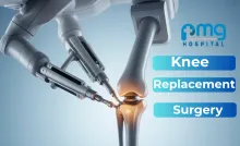 Knee Replacement Surgery